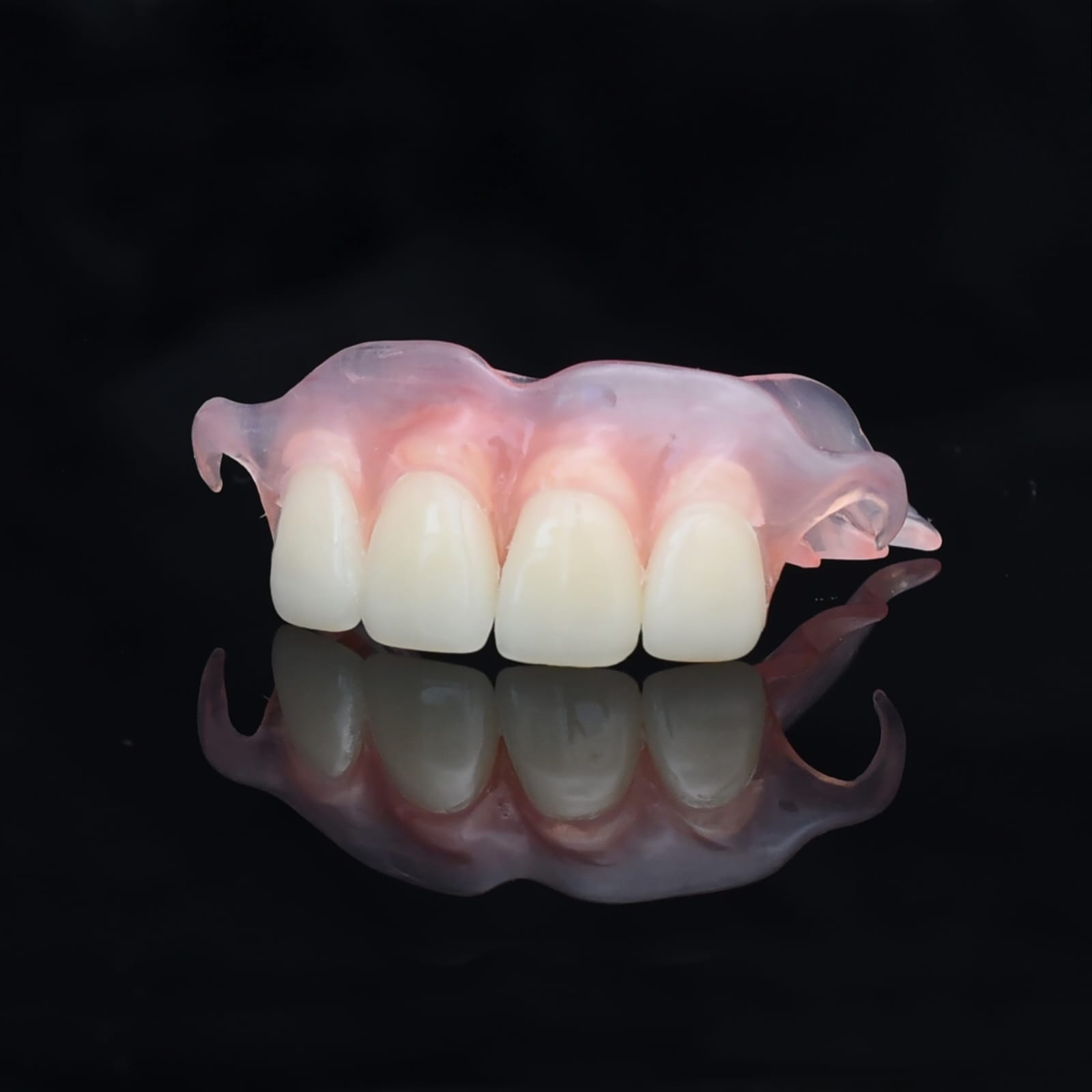 Anterior Flexible Partial Denture