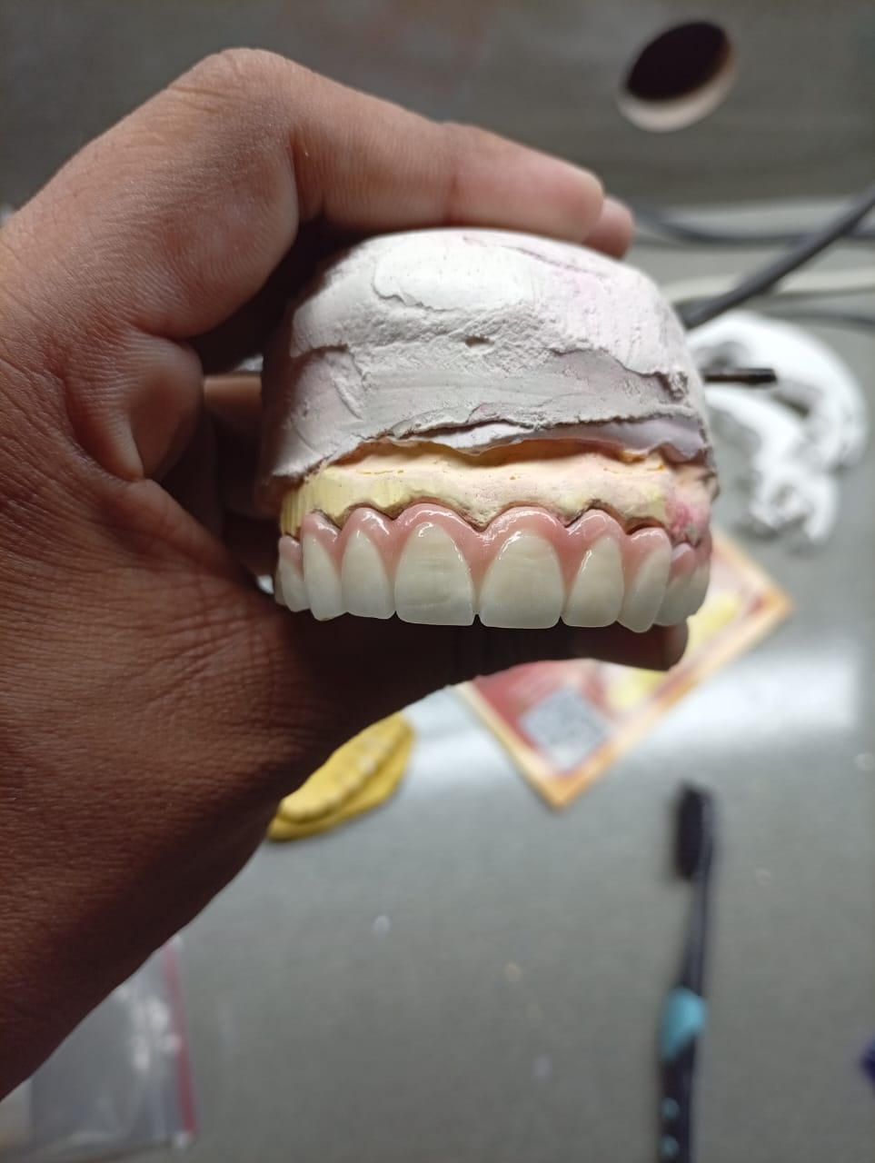 Sublingual Plate & Minor Connectors